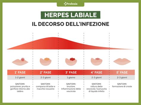 Infografica sui fattori scatenanti e preventivi dell'herpes labiale