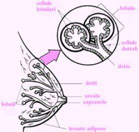Schema dei dotti lattiferi del seno con cellule normali e cellule di DCIS
