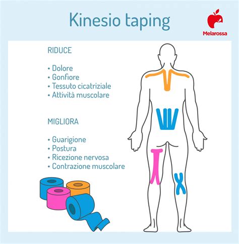 Schema dell'applicazione del NeuroMuscular Taping su una cicatrice