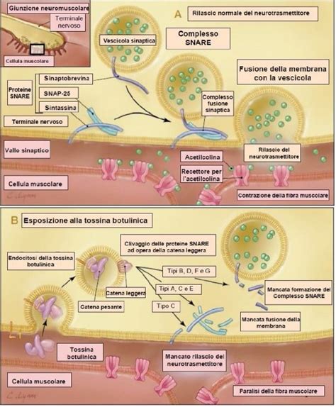 Schema che illustra il meccanismo d'azione della tossina botulinica sullo sfintere anale