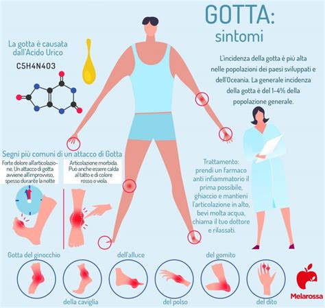 Articolazione colpita da gotta